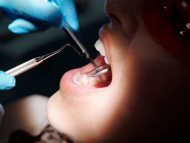 Odontología biológica vs. odontología convencional: Un análisis profundo